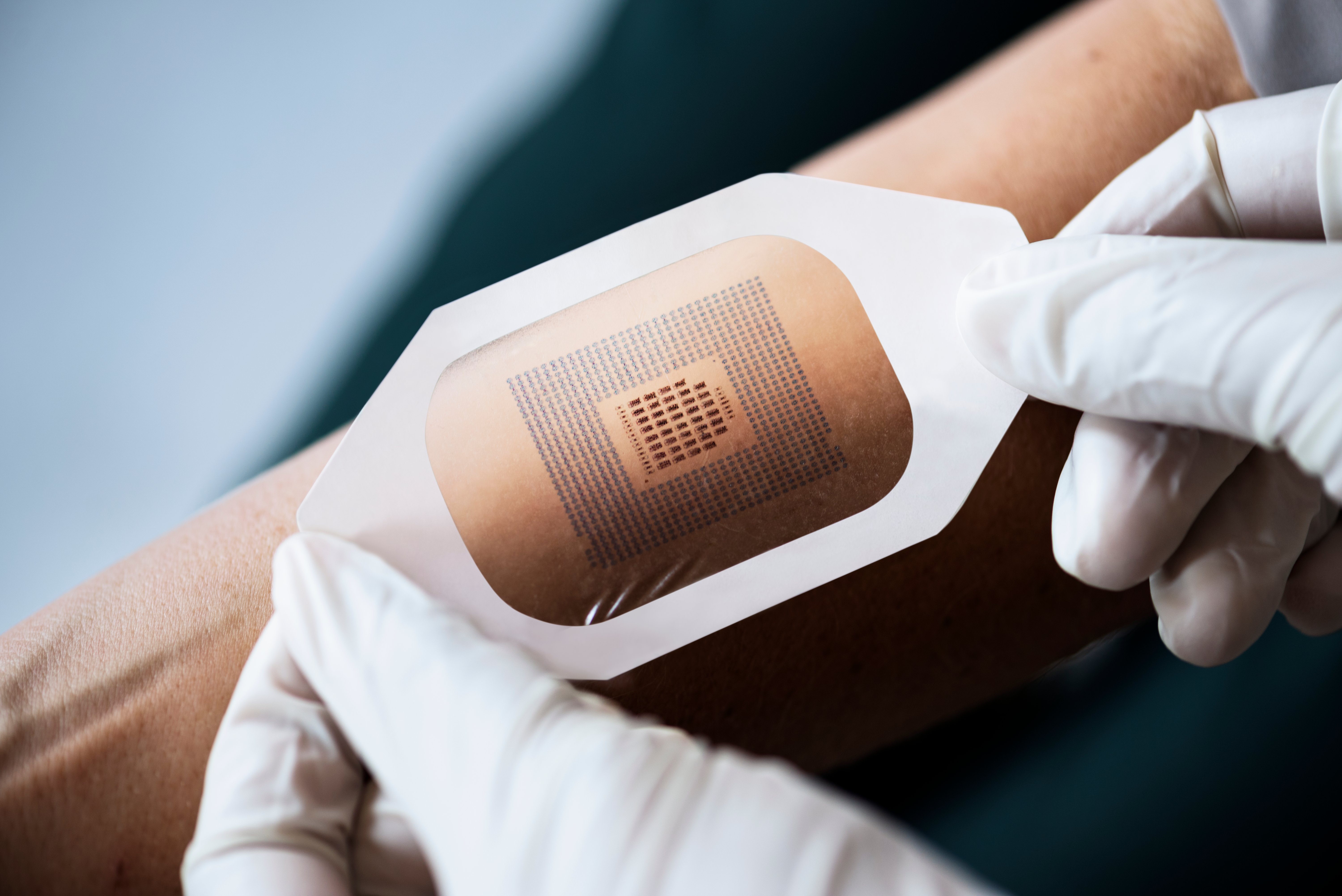 What to Consider When Selecting Adhesives for Medical Fixation Devices